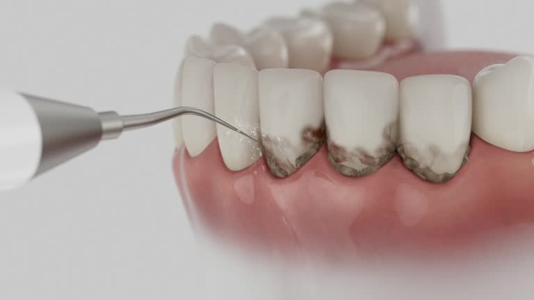 Reliable Dental contractor in Lake LeAnn, MI by Dentist Open Now